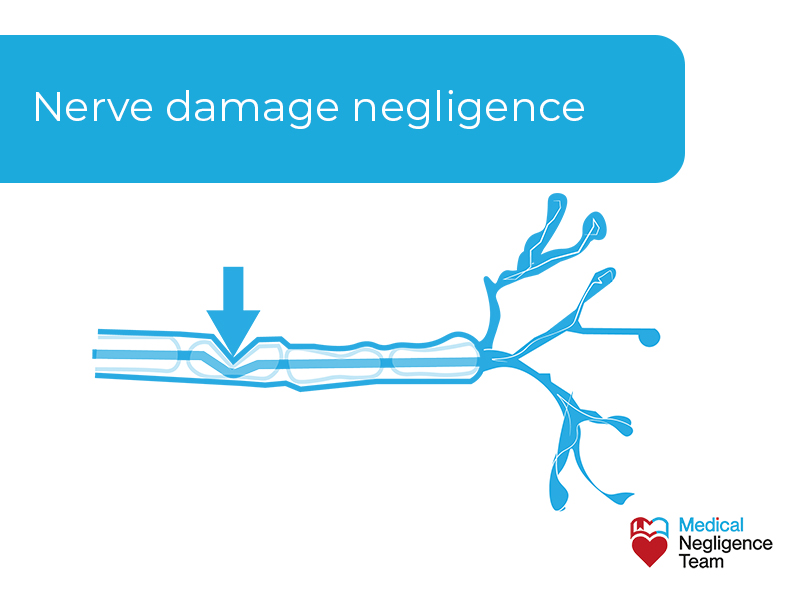 A nerve can be severed in any type of surgery