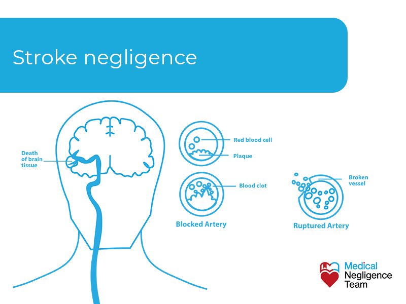 Stroke Misdiagnosis Leading To Brain Injury