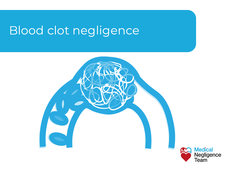 failure to diagnose or treat a blood clot
