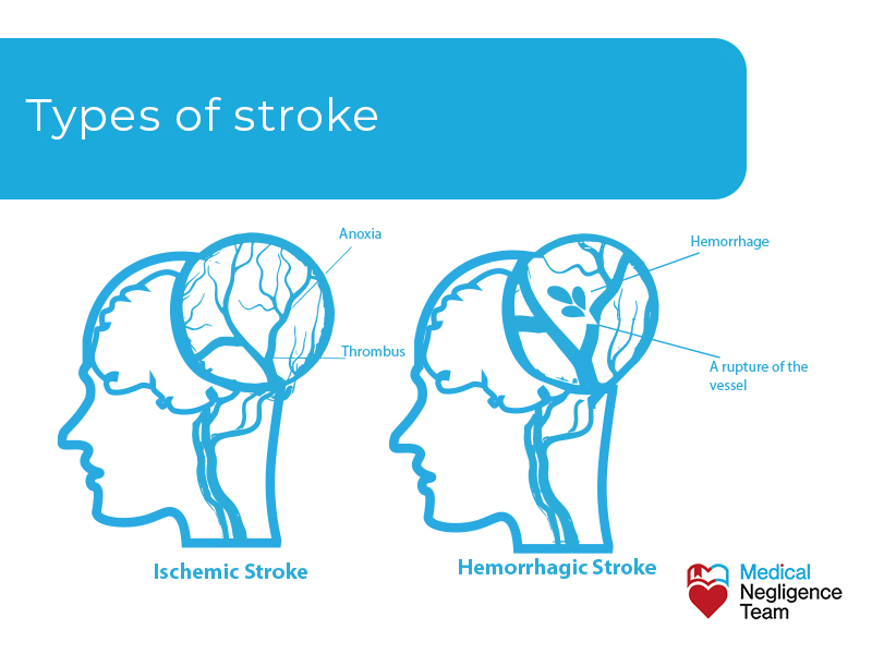 two types of stroke