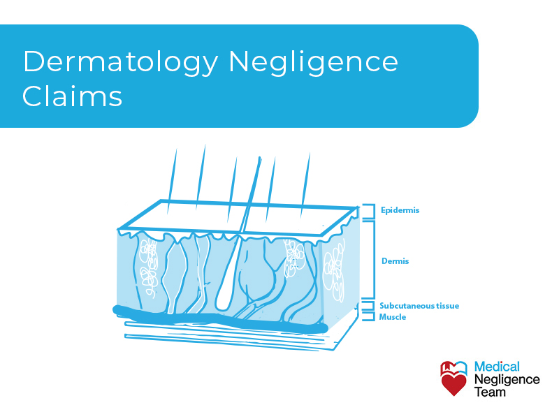 Dermatology Negligence Claims