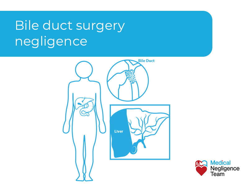 Claim for bile duct surgery negligence