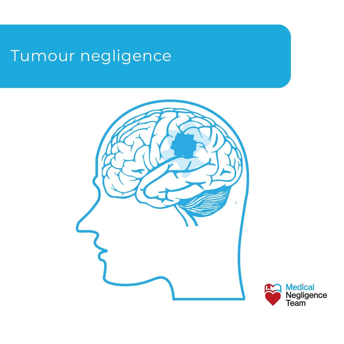 Tumour negligence